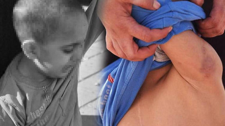 5 yaşındaki zihinsel engelli çocuğa okulda şiddet