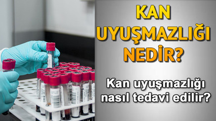 Kan uyuşmazlığı nedir Kan uyuşmazlığı nasıl tedavi edilir