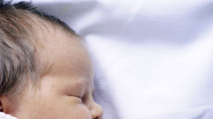 Mide ilacı yerine saçkıran ilacı verilen 17 bebek ‘kurt adam’a döndü