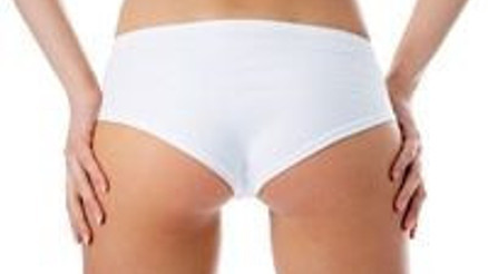 Selülitiniz hangi aşamada