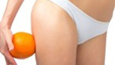 Tatile selülitlerinizi götürmeyin