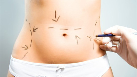 Karın Germe Ve Karın Estetiği