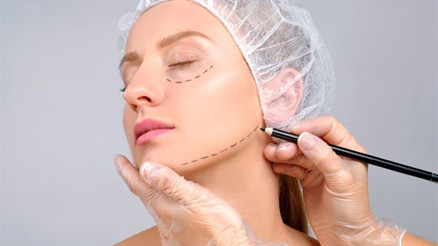 Yanak Estetiği (Bişektomi) Nedir