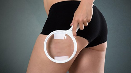 Selülit Nasıl Geçer ve Ne İyi Gelir Selülit Neden Olur Evde Selüliti Geçirecek Bitkisel Çözümler ve Doğal Yollar