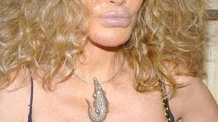 Estetik kurbanı Jocelyn Wildenstein