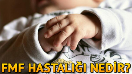 FMF (Ailevi Akdeniz Ateşi) hastalığı nedir, belirtileri nelerdir FMF tedavisi nasıl yapılır FMF (Ailevi Akdeniz Ateşi) hastalığı nedir, belirtileri nelerdir FMF tedavisi nasıl yapılır