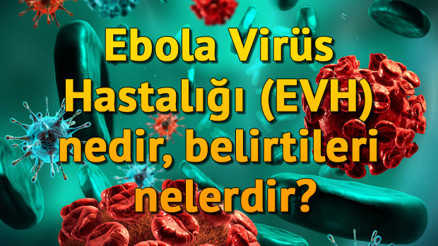 Ebola Virüs Hastalığı (EVH) nedir, belirtileri nelerdir
