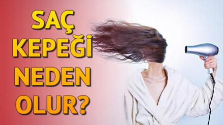 Saç kepeği nasıl geçer İşte kepek oluşumunu engellemek için yapılması gerekenler