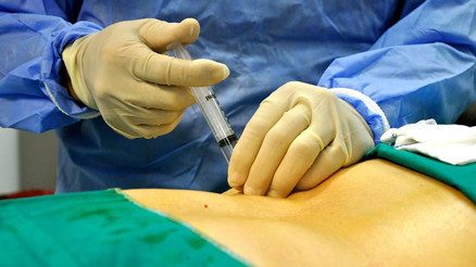 Kasık fıtığı belirtileri neler Kasık fıtığı neden olur ve tedavisi nasıl yapılır