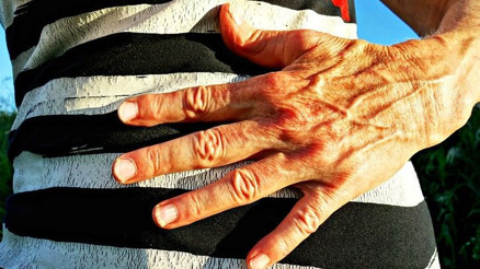 Gaz sıkışmasına ne iyi gelir ve nasıl geçer Gaz sıkışması neden olur Yetişkinlerde gaz sıkışmasına iyi gelen bitkisel çözümler ve doğal yöntemler