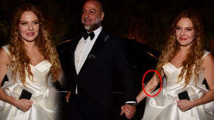 Naz Elmas hamile mi Dikkat çeken detay...