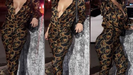 Estetik tutkusu sınır tanımıyor 23üncü kez ameliyat olacak Estetik tutkusu sınır tanımıyor 23üncü kez ameliyat olacak