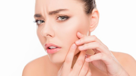 Sivilce İzleri Nasıl Geçer Sivilce İzleri Nasıl Geçer