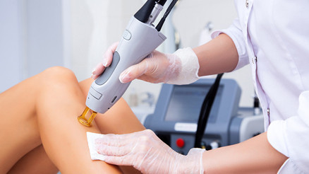 Lazer İle Tüy Sarartma Uygulaması Nedir