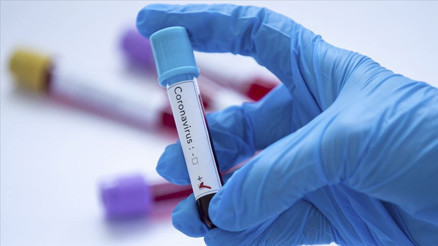 Dev şirket kapattı: 10 bin personel fazlalığı var Korkunç tahmin