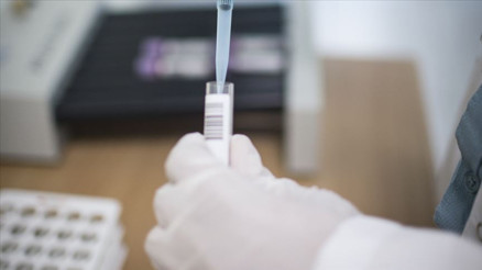 Remdesivir nedir Corona tedavisinde kullanılan Remdesivir ilacı hakkında bilgiler