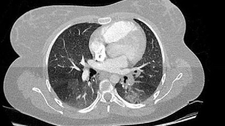 SON DAKİKA HABERİ: Bilim insanlarından kritik koronavirüs açıklaması (4 Haziran)