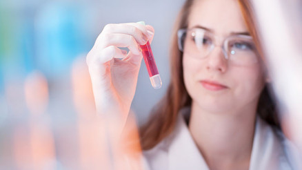 Arteriyel Kan Gazı So2 nedir Değeri kaç olmalıdır Düşüklüğü ile yükseliği nedenleri ve belirtileri
