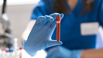 HGB nedir, değeri kaç olmalı HGB düşüklüğü ile yükseliği nedenleri ve belirtileri