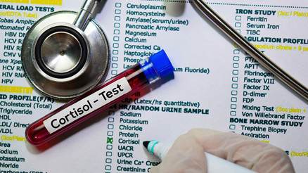 Kortizol nedir Kortizol değeri kaç olmalıdır Düşüklüğü ile yüksekliği nedenleri ve belirtileri