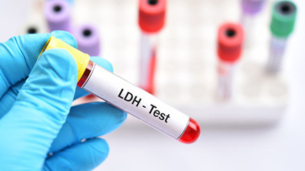 Laktat nedir Laktat değeri kaç olmalıdır Düşüklüğü ile yüksekliği nedenleri ve belirtileri