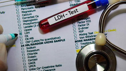 Ldh nedir Ldh değeri kaç olmalıdır Düşüklüğü ile yüksekliği nedenleri ve belirtileri