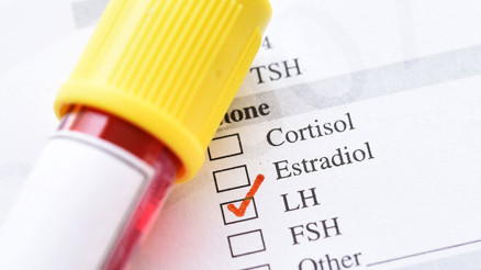 Lh hormonu nedir Lh hormonu değeri kaç olmalıdır Düşüklüğü ile yükseliği nedenleri ve belirtileri