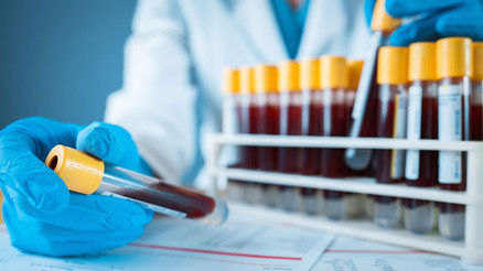 MCHC nedir MCHC değeri kaç olmalıdır Düşüklüğü ile yüksekliği nedenleri ve belirtileri