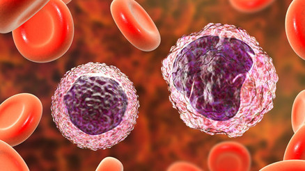 MON (monosit) nedir MON değeri kaç olmalıdır Düşüklüğü ile yüksekliği nedenleri ve belirtileri