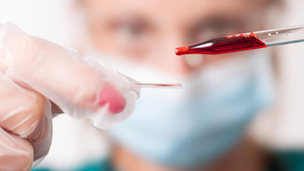 PDW nedir PDW değeri kaç olmalıdır Düşüklüğü ile yüksekliği nedenleri ve belirtileri