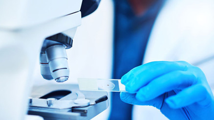 RF nedir RF değeri kaç olmalıdır Düşüklüğü ile yüksekliği nedenleri ve belirtileri