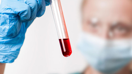 UIBC nedir UIBC kan değeri kaç olmalıdır Düşüklüğü ile yüksekliği nedenleri ve belirtileri