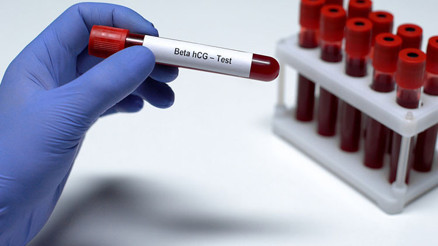 Beta HCG değeri nedir Beta HCG normal değeri kaç olmalıdır Düşüklüğü ile yüksekliği nedenleri ve belirtileri