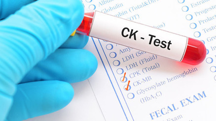 CK kreatin kinaz nedir CK kreatin kinaz değeri kaç olmalıdır Düşüklüğü ile yüksekliği nedenleri ve belirtileri
