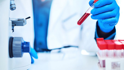 EO nedir EO kan değeri kaç olmalıdır Düşüklüğü ile yüksekliği nedenleri ve belirtileri