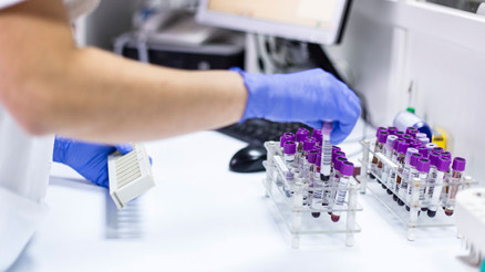 Estradiol nedir Estradiol değeri kaç olmalıdır Düşüklüğü ile yüksekliği nedenleri ve belirtileri