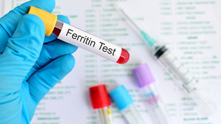 Ferritin nedir Ferritin değeri kaç olmalıdır Ferritin eksikliği ile yüksekliği nedenleri ve belirtileri