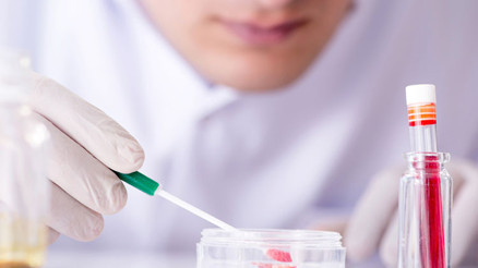 Fosfor nedir Fosfor değeri kaç olmalıdır Düşüklüğü ile yüksekliği nedenleri ve belirtileri