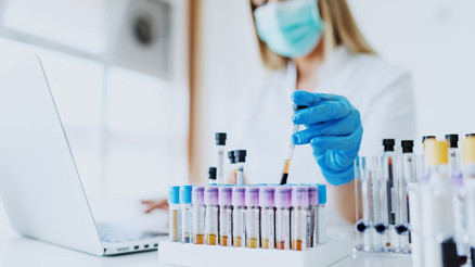 FSH hormonu nedir FSH hormonu değeri kaç olmalıdır Düşüklüğü ile yüksekliği nedenleri ve belirtileri