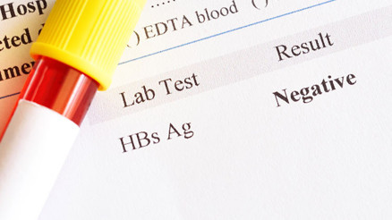 HBSAG nedir HBSAG değeri kaç olmalıdır Düşüklüğü ile yüksekliği nedenleri ve belirtileri