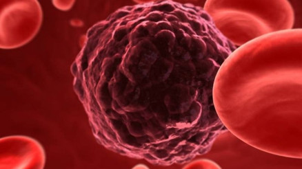 Kanser belirtileri nelerdir