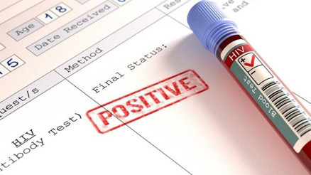 HIV virüsü taşıyanlar çocuk sahibi olabilir mi