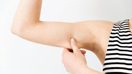 Kollarda oluşan sarkmalardan kurtulmak mümkün mü