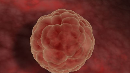 Jinekolojik kanser türleri nelerdir