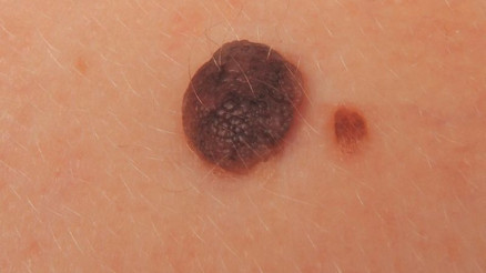 Benlerinizi önemseyin, mutlaka kontrol ettirin