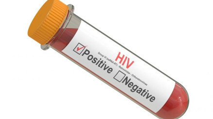 Aids hakkında merak ettiğiniz tüm soruların yanıtları