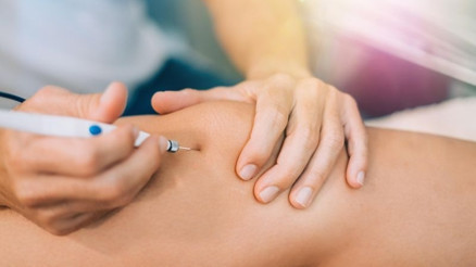 Proloterapi tedavisi nedir