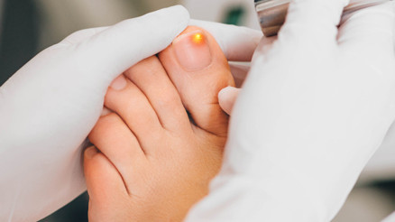 Tırnak Mantarı Nasıl Geçer