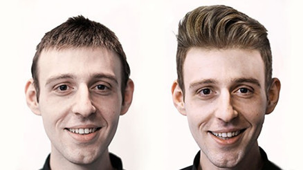 Protez saç hakkında merak edilenler