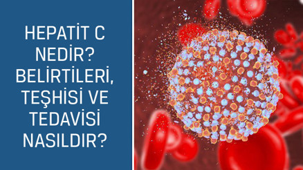 Gastroenteroloji ve Hepatoloji Uzmanı Doç. Dr. Salih Boğa cevaplıyor; Hepatit C nedir Belirtileri, teşhisi ve tedavisi nasıldır